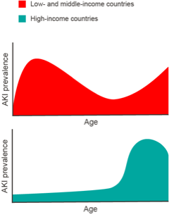 Indicative trend of acute kidney injury prevalence according to patient’s age in high- and low- and middle-income countries. Courtesy of Pr. Abdou Niang.
